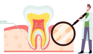 Exploring the Benefits of Dental Implants